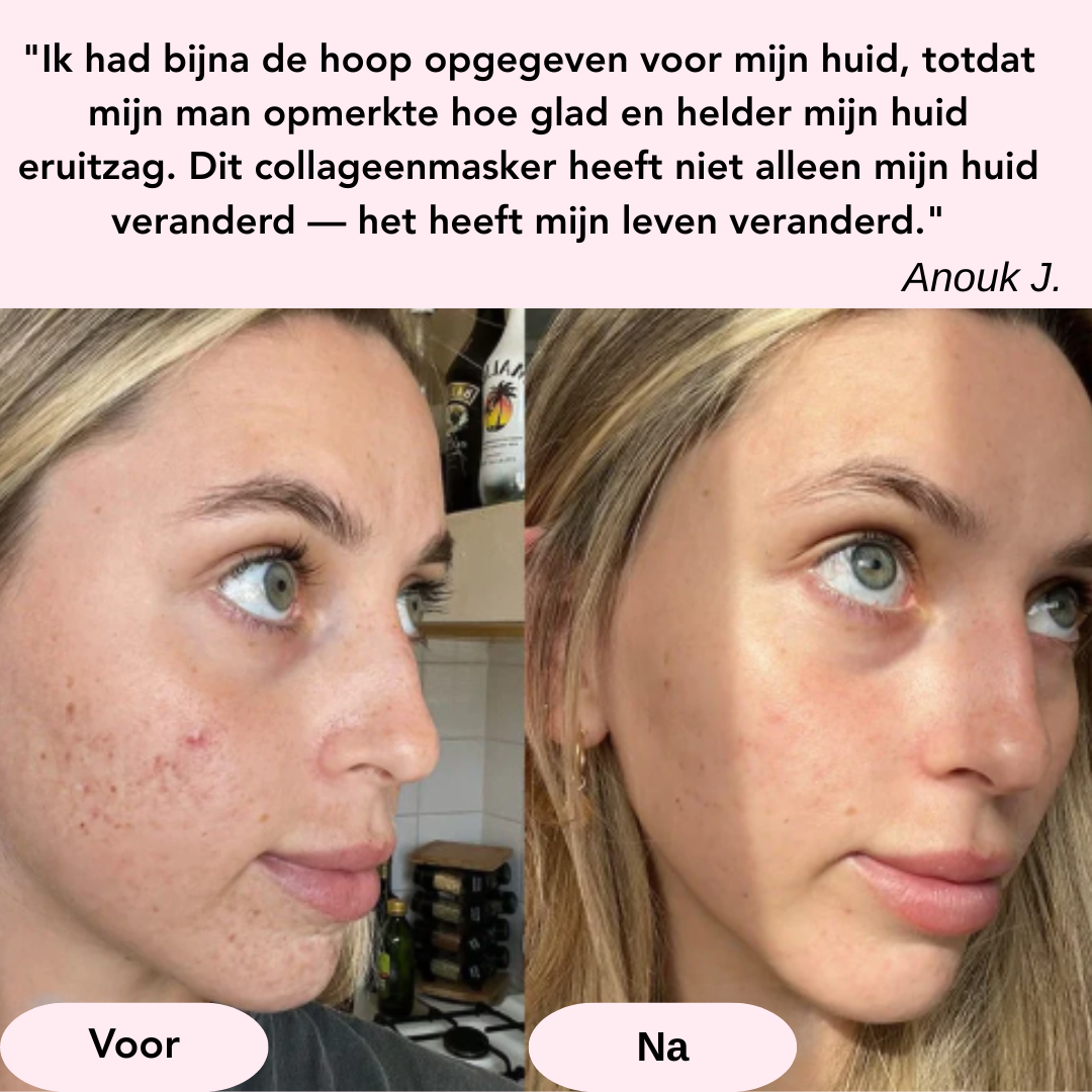 Een Stralend Gezicht in Een Nacht (4 CollageenMaskers)