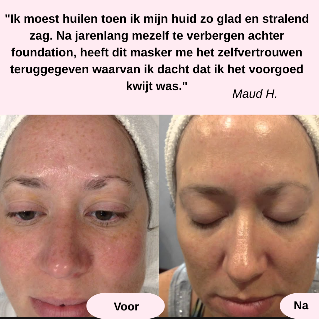 Een Stralend Gezicht in Een Nacht (4 CollageenMaskers)
