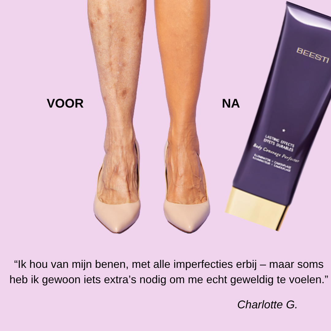 Vlekkeloos Lichaamsconcealer™
